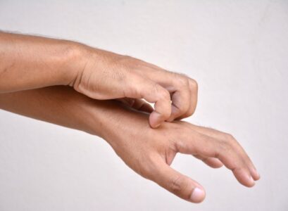 What-is-best-for-mosquito-bites-effective-and-simple-treatments