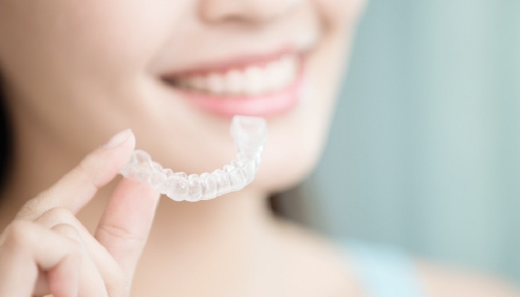how clear aligners work advantages 