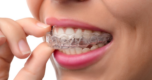 modern methods of teeth alignment