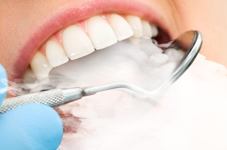 cigarette smoke comes out from dentist patient mouth