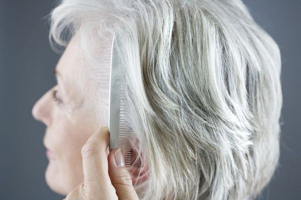 age is the most common hair loss reason