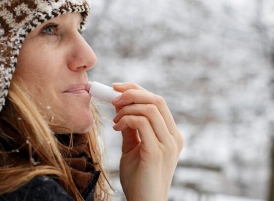 Winter-lip-balm-recipes-to-prevent-problems-during-the-cold-months