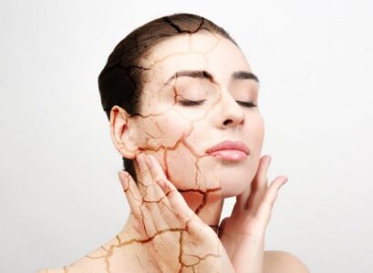 Easy-treatments-for-dry-skin-at-home