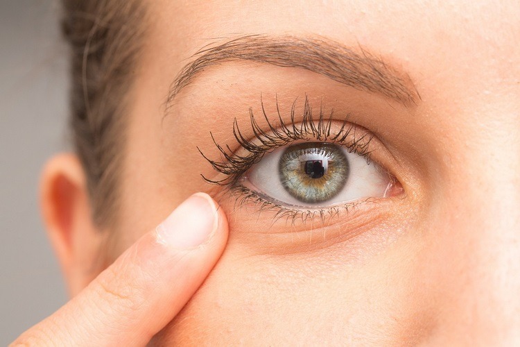 Bags under the eyes can appear as a result from a variety of reasons