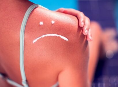 How-to-Avoid-Sunburn-and-Effective-Home-Remedies-for-Burned-Skin