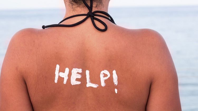 What to Do If You Get Sunburn