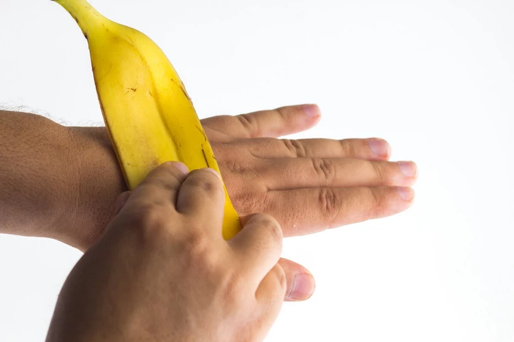 banana peels for removing moles home remedies