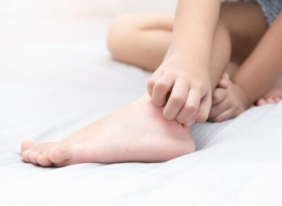 How-to-Get-Rid-of-Bedbug-Bites-Natural-Remedies-to-Relieve-the-Itching