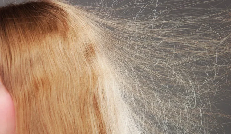 Simple Methods to Get Rid Of Static Electricity and Fix Your Hair