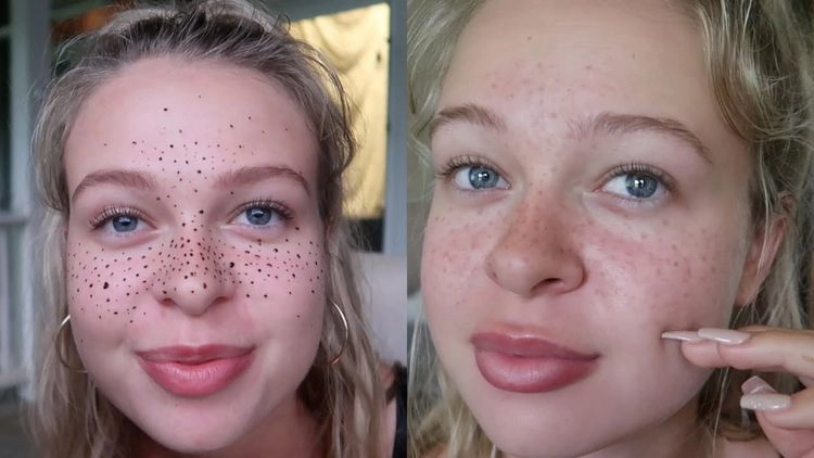 Important tips for freckles with henna