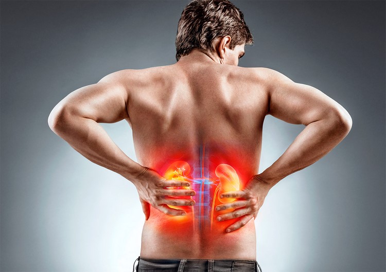 Kidney Stone Pain The Most Painful Thing You Can Experience