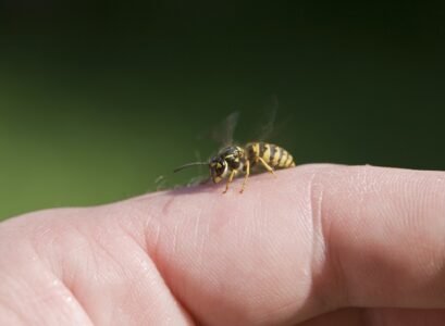 home-remedies-for-wasp-stings-to-relieve-symptoms