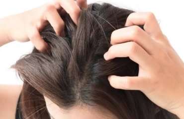 itchy-scalp-natural-grandmother-remedies-anti-itching