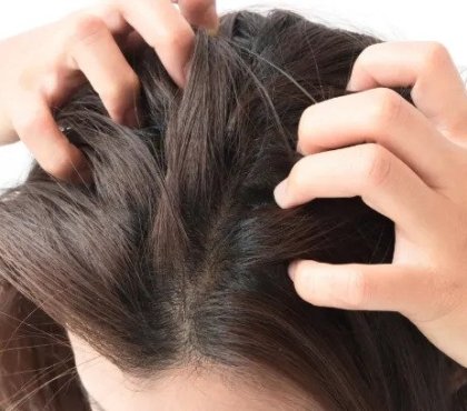 itchy-scalp-natural-grandmother-remedies-anti-itching