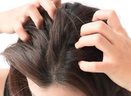 itchy-scalp-natural-grandmother-remedies-anti-itching