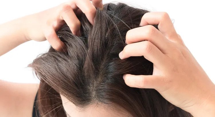 itchy scalp natural grandmother remedies anti itching
