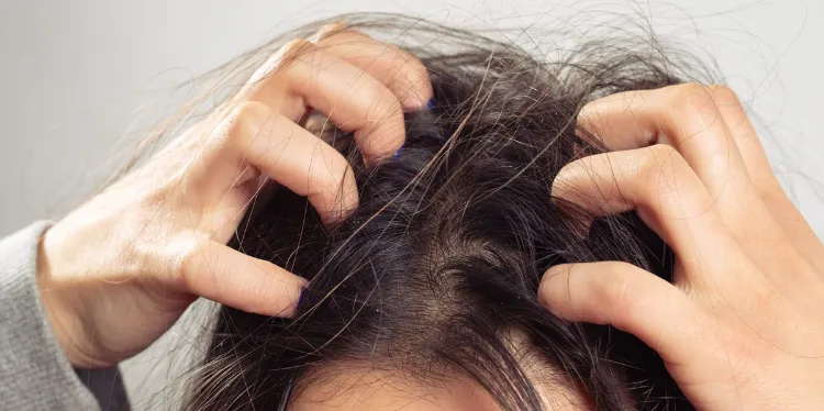 itchy scalp without dandruff natural remedies