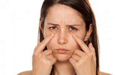 how to get rid of under eye bags home remedies treatment diet healthy lifestyle medication