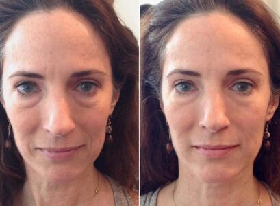 DIY-Anti-wrinkle-facial-massage-tutorial