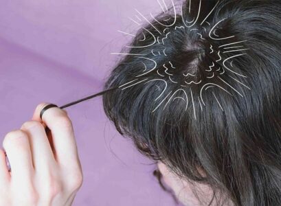 hair cracking_scalp popping