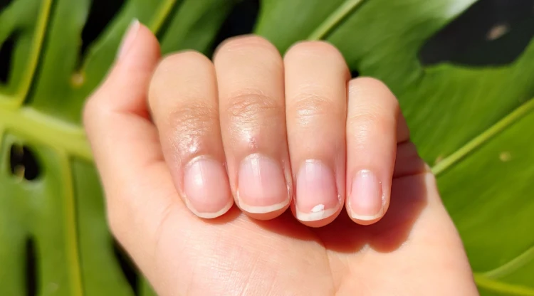 healthy looking nails nail care and treatment of diseases