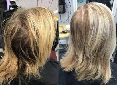 What-is-the-best-hairstyle-for-thinning-hair-must-have-accessories-and-styling-products