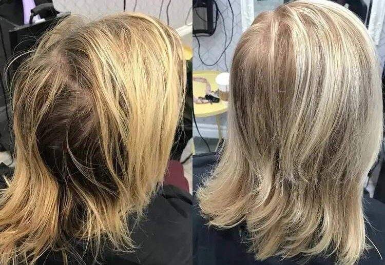 What-is-the-best-hairstyle-for-thinning-hair-must-have-accessories-and-styling-products