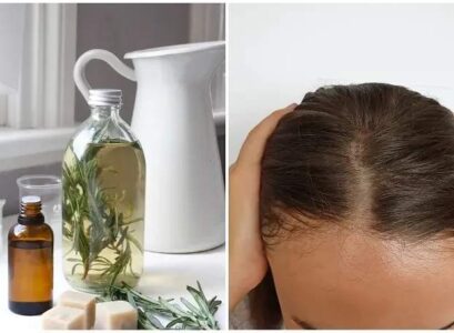 what are the benefits of rosemary for hair