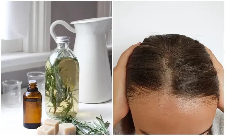 what are the benefits of rosemary for hair