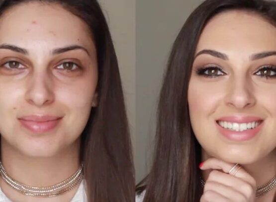 how to treat dark circles effectively women over 50 years