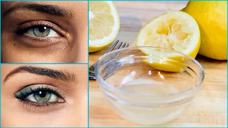 lemon juice natural remedies healthy collagen production