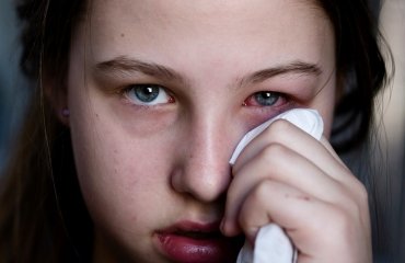 pink eye symptoms-reddish-eyes-inflammation-and-itching