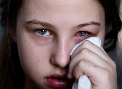 pink eye symptoms-reddish-eyes-inflammation-and-itching