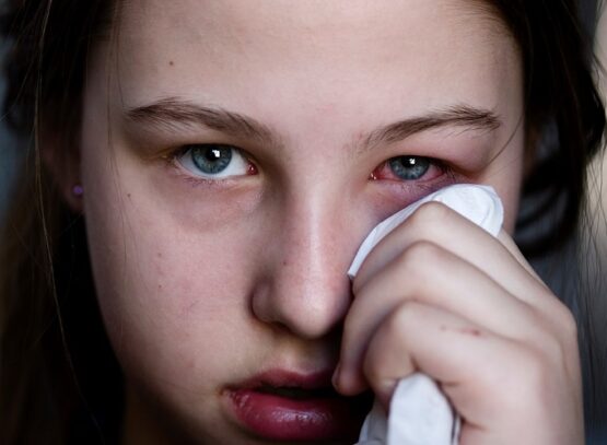 pink eye symptoms-reddish-eyes-inflammation-and-itching