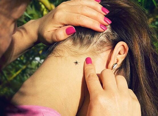 does vinegar kill ticks a woman with a tick on the skin