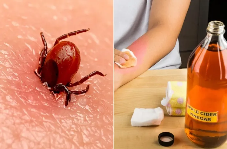 does vinegar kill ticks in combination with other remedies 1