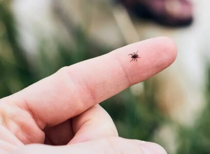 tick bite treatment first aid home remedies care instructions