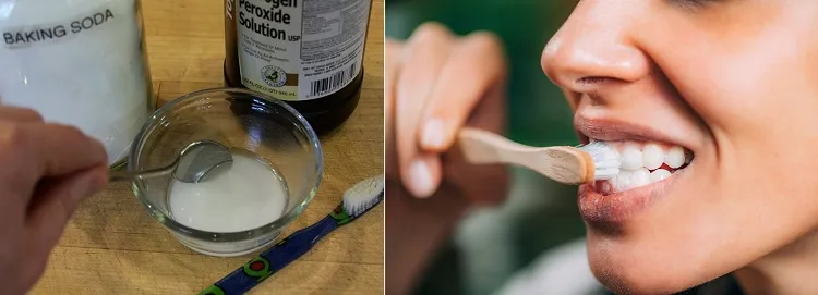 how to whiten teeth with baking soda and peroxide to have white teeth