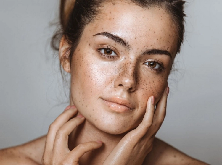 remove pigment spots using home remedies face masks