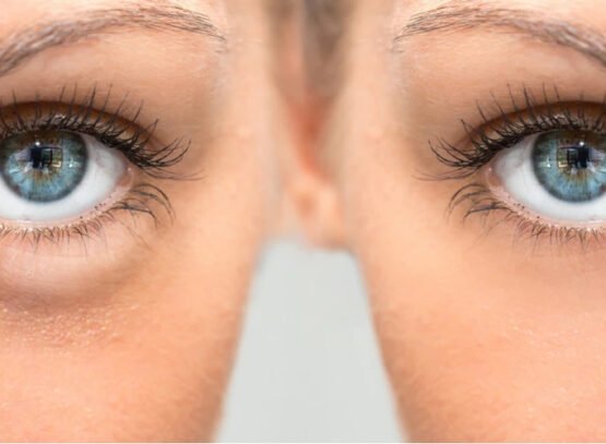 how to get rid of puffy eyes in the morning tried and true home remedies