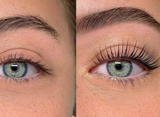 best lash booster 2023