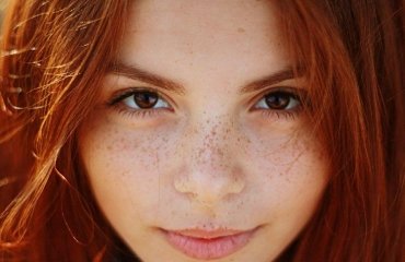 how can i lighten my freckles naturally flat genetic light brown spots on your face that do not disappear unless you do something to lighten them show after exposed to sun