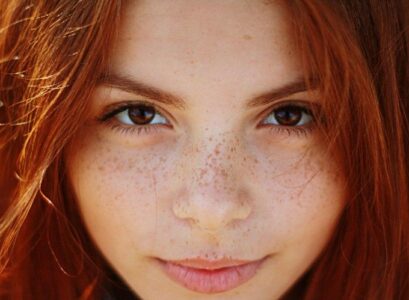 how can i lighten my freckles naturally flat genetic light brown spots on your face that do not disappear unless you do something to lighten them show after exposed to sun