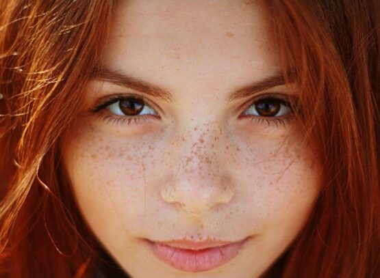 how can i lighten my freckles naturally flat genetic light brown spots on your face that do not disappear unless you do something to lighten them show after exposed to sun