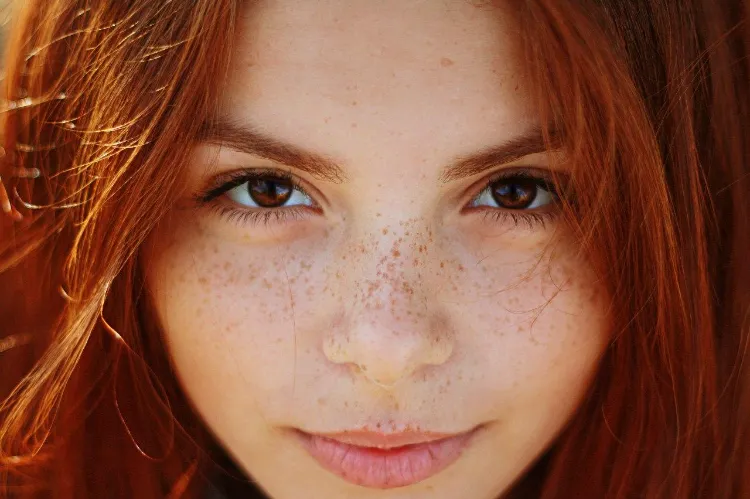 how can i lighten my freckles naturally flat genetic light brown spots on your face that do not disappear unless you do something to lighten them show after exposed to sun