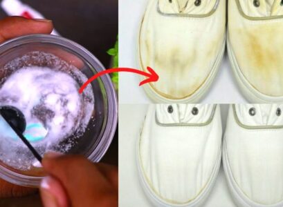 how to remove yellow stains from white shoes can literally suit any outfit from those with colorful patterns to the most basic and neutral ones the perfect choice for people