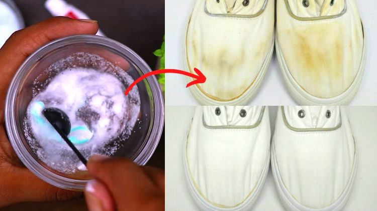How to Remove Yellow Stains from White Shoes Effectively?