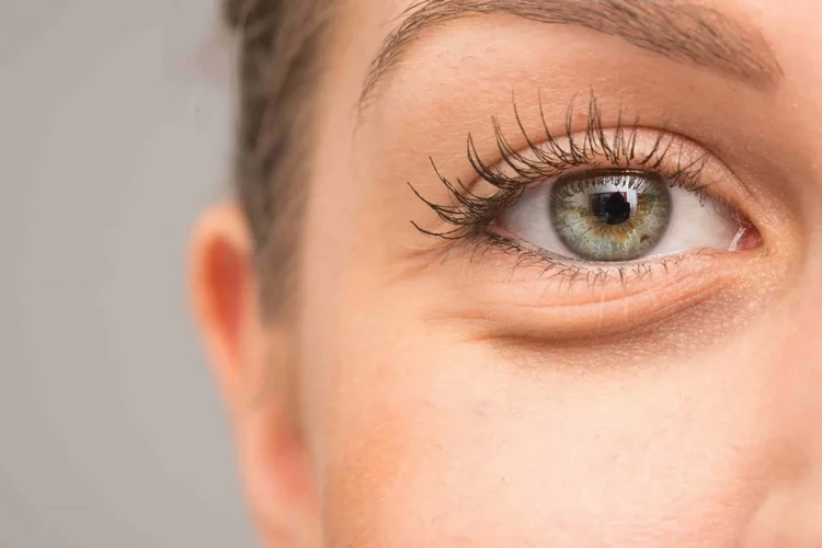 what causes puffy eyes in the morning