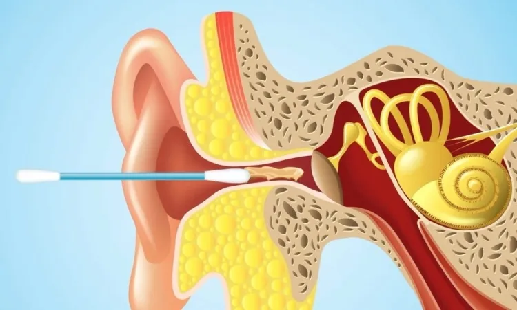 what is the best way to clean your ears