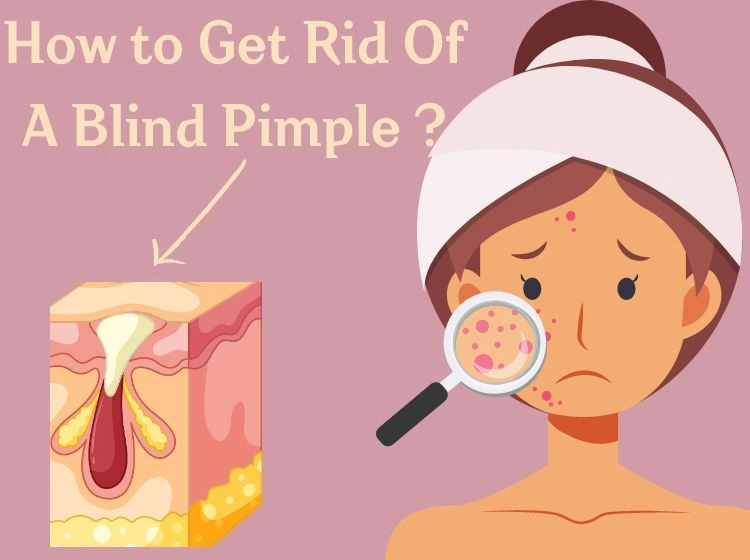 how to get rid of a pimple thats under your skin methods skincare ideas fast